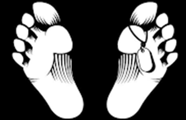 Hisar Jindal Rolling Mill Blast: Another Injured worker Succumbs, Toll Reaches Two