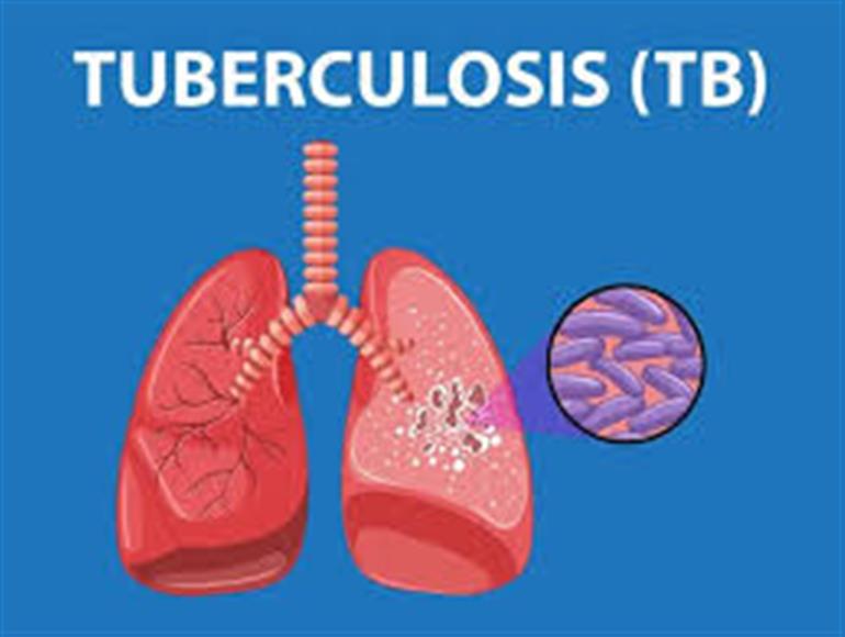 New campaign for TB patients; all departments under Ministry of Housing and Urban Affairs to participate