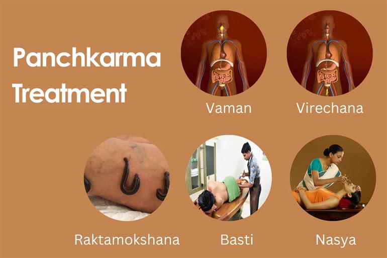 AYUSH department to launch Panchkarma technician courses in 12 ayurvedic hospital  