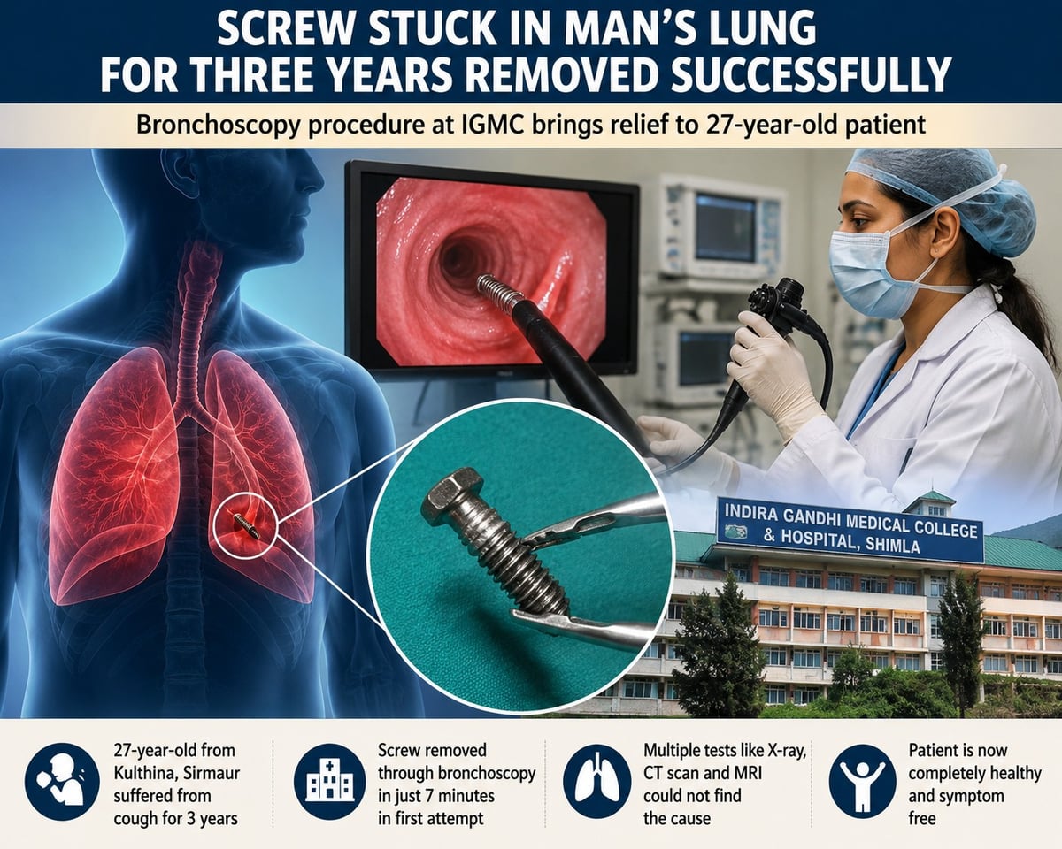 Screw Stuck in Man’s Lung for Three Years Removed Successfully at IGMC
