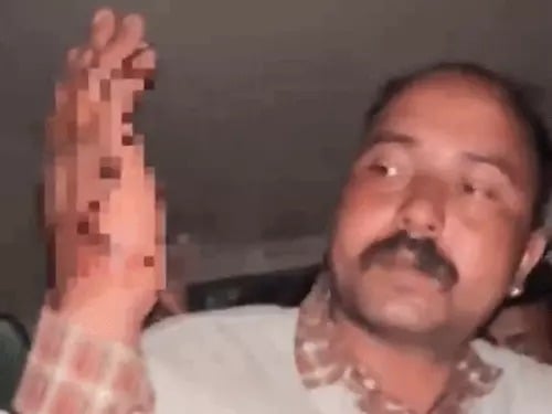 Punjab Tourists Brandish Swords in Himachal, Two Locals Injured; Residents Allege Drug Influence