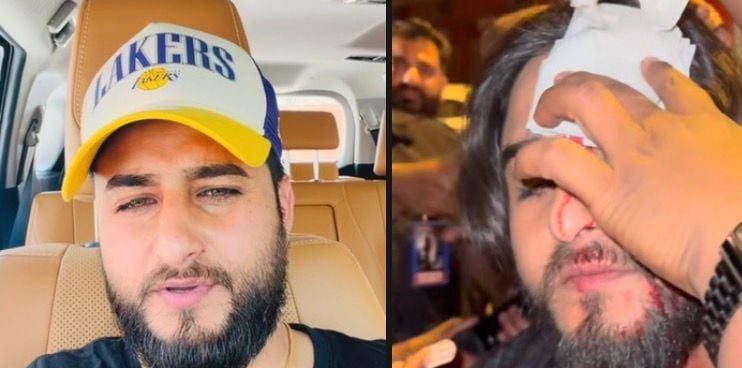 'Dhurandhar' fame singer Injured During Music Video Shoot for New Song ‘Pagal Nayi Hona’
