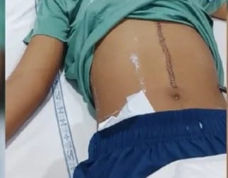 Bench dispute turns violent at Jalandhar school, student undergoes surgery, gets 22 stitches